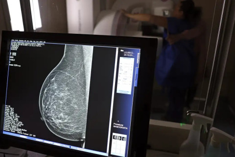 Planos de saúde terão que cobrir mamografia digital sem limite de idade